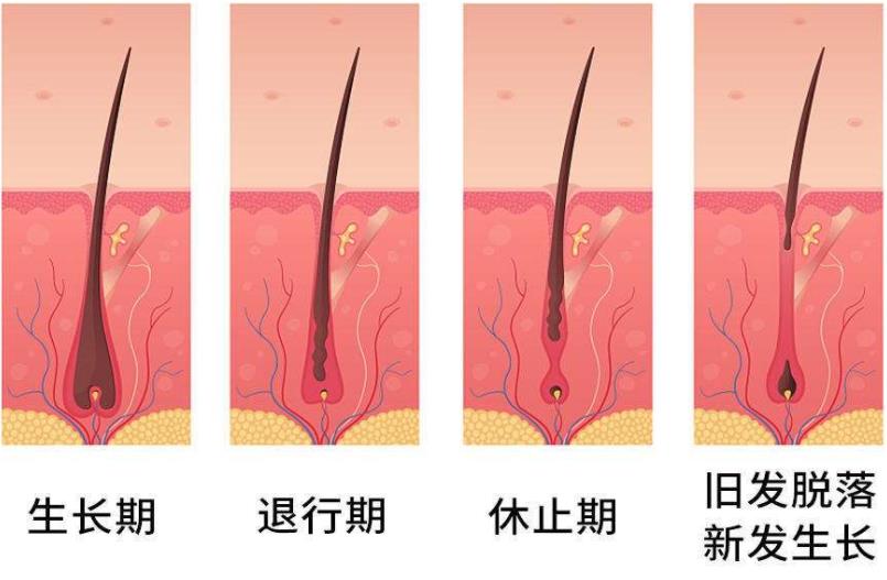 掉多少头发属于正常？