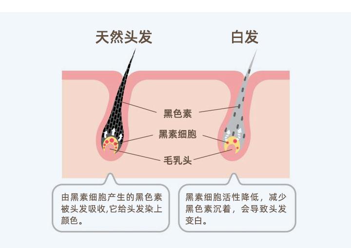 年轻人为什么会长白头发？如何预防白发？