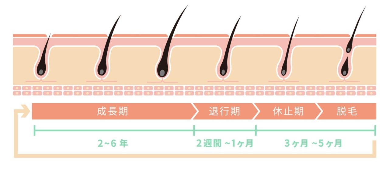 每6人中就有1人脱发？